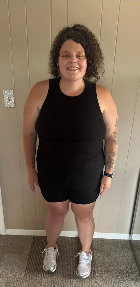 After: medical weight loss