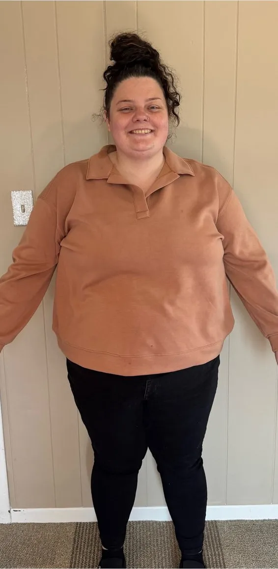Before: medical weight loss